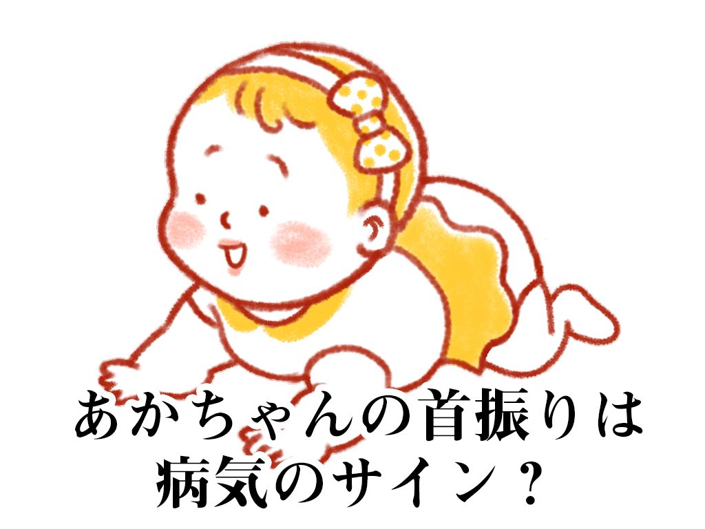 第80回 あかちゃんの首振りは病気のサイン 現役保育士の子育て 保育豆知識